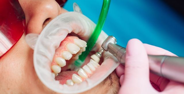 5 Surpri****g Benefits of Regular Teeth Cleaning in Marietta – @danieljames0458 on Tumblr