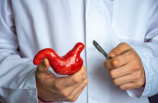 Bariatric Surgery in Islama**** Rawalpindi Pakistan