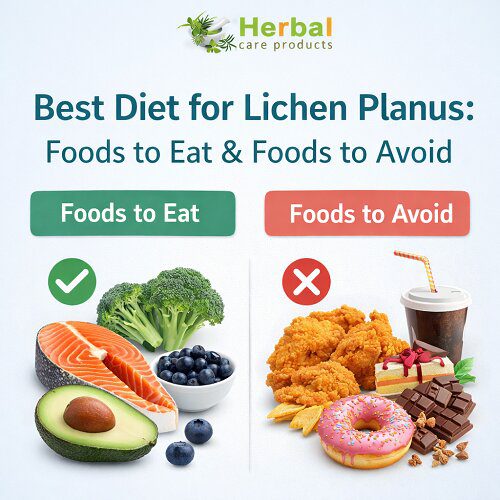 Best Diet for Lichen Pl****: Foods to Eat & Foods to Avoid